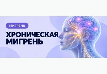 Лечение хронической мигрени